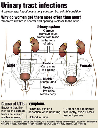 Symptoms Of A Urinary Tract Infection In Women - How To Tell If You Have A Kidney Cyst many ways