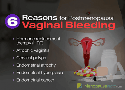 What is the Most Common Symptoms of Vaginal Atrophy? It is